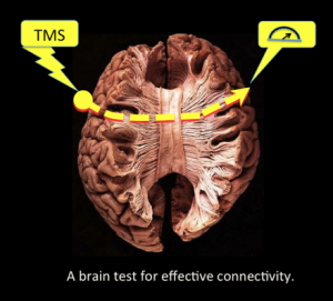 "Transcranial Brain Stimulation in Human Brain Portrayal"