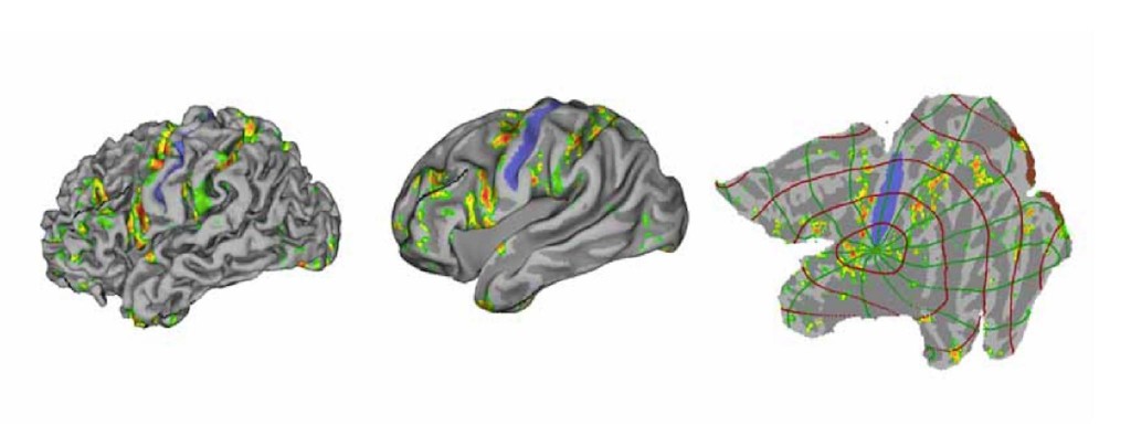 "Your Cortex is a Flat Sheet Image"
